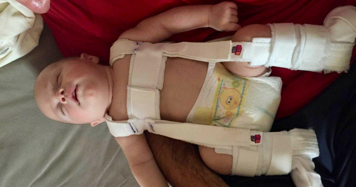 Ce bébé né accro à la drogue avec une jambe cassée vit l’enfer