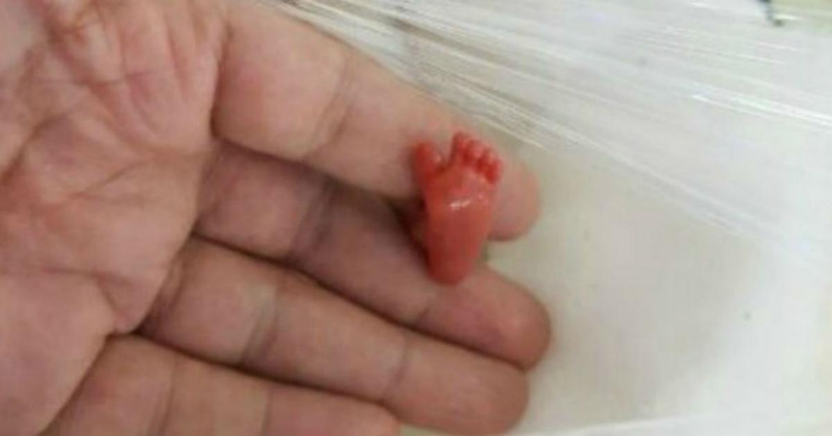 Un enfant né prématurément de 12 semaines devient le plus petit bébé du monde à avoir survécu.