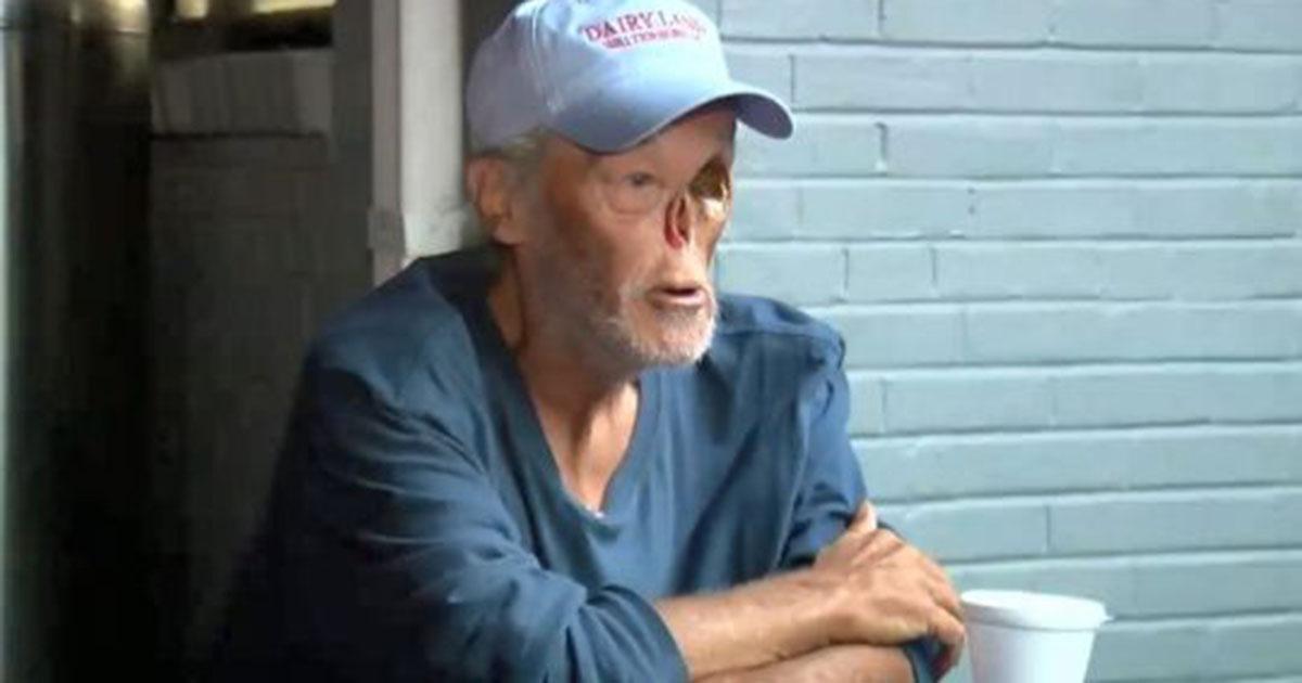 Un homme qui a perdu son nez et un oeil à cause du cancer est expulsé d’un restaurant à cause de son apparence