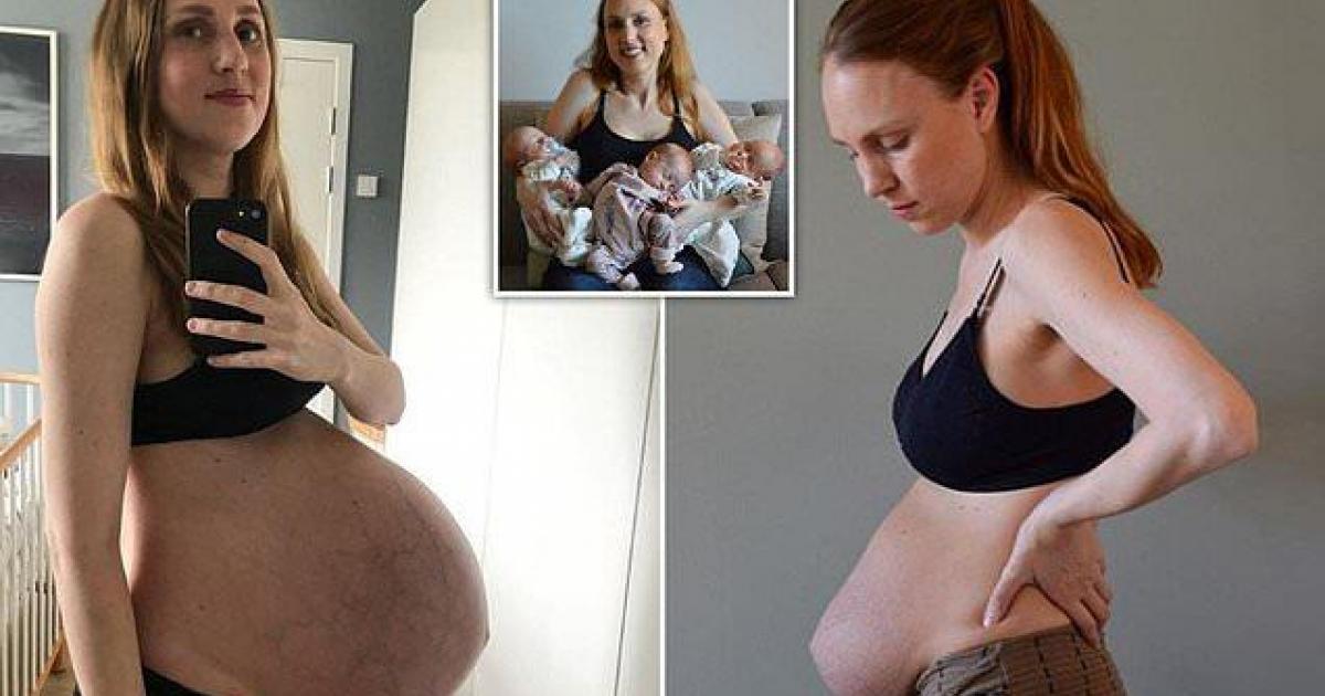 Une mère montre à quoi ressemble son corps après avoir accouché de triplés!