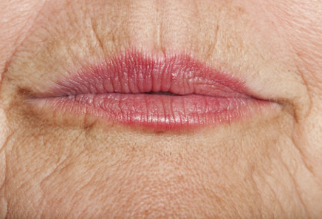 Pourquoi les lèvres s’affinent-elles en vieillissant ? – SciencePost