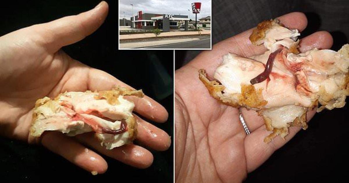 Une mère veut poursuivre KFC après avoir été empoisonnée par un morceau de poulet mal cuit.