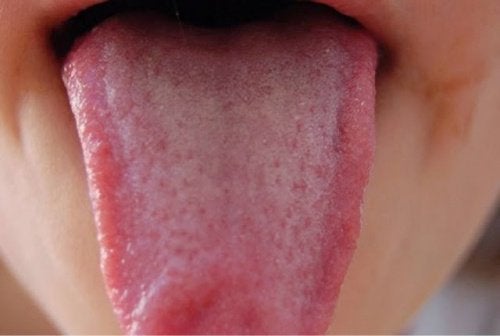 Remèdes naturels pour désinfecter la langue — Améliore ta Santé