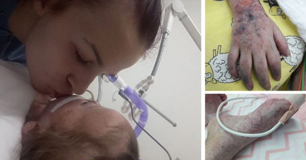 Une maman publie des photos bouleversantes de sa fille décédée de la rougeole