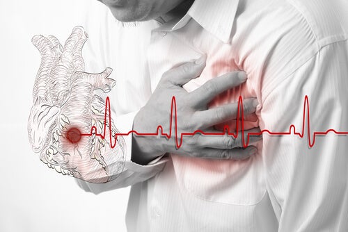 L’infarctus aigu du myocarde — Améliore ta Santé