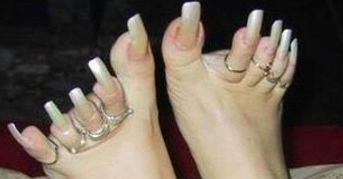 12 photos des pires pieds au monde
