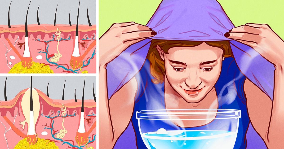 6 Choses qui peuvent arriver Ã  ton visage si tu lui fais des bains de vapeur une fois par semaine