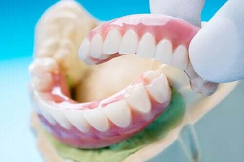 Bridge dentaire : types, bénéfices et inconvénients – Améliore ta Santé