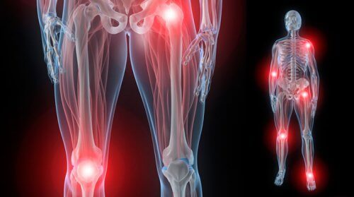 5 solutions naturelles contre la rigiditÃ© articulaire provoquÃ©e par l’arthrite