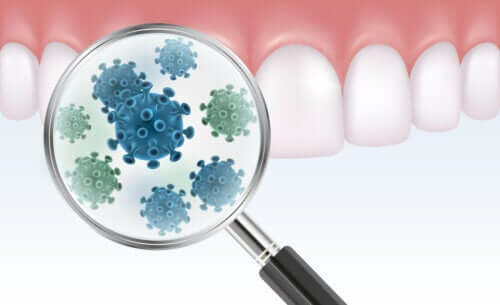 Tout ce que vous devez savoir sur la plaque bactÃ©rienne dentaire