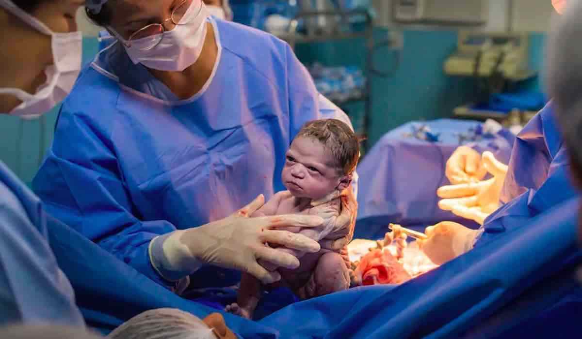 Quelques secondes après sa naissance, un nouveau-né regarde fixement les médecins avec un regard noir