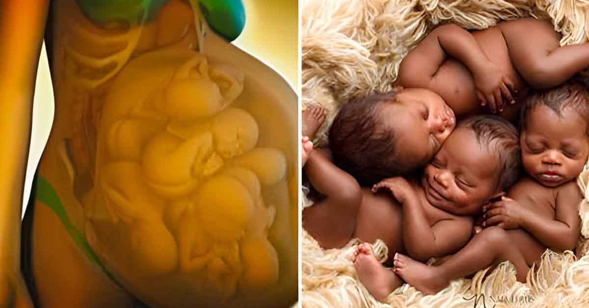 Si vous vous êtes déjà demandé à quoi ressemble une grossesse multiple, découvrez des images fascinantes